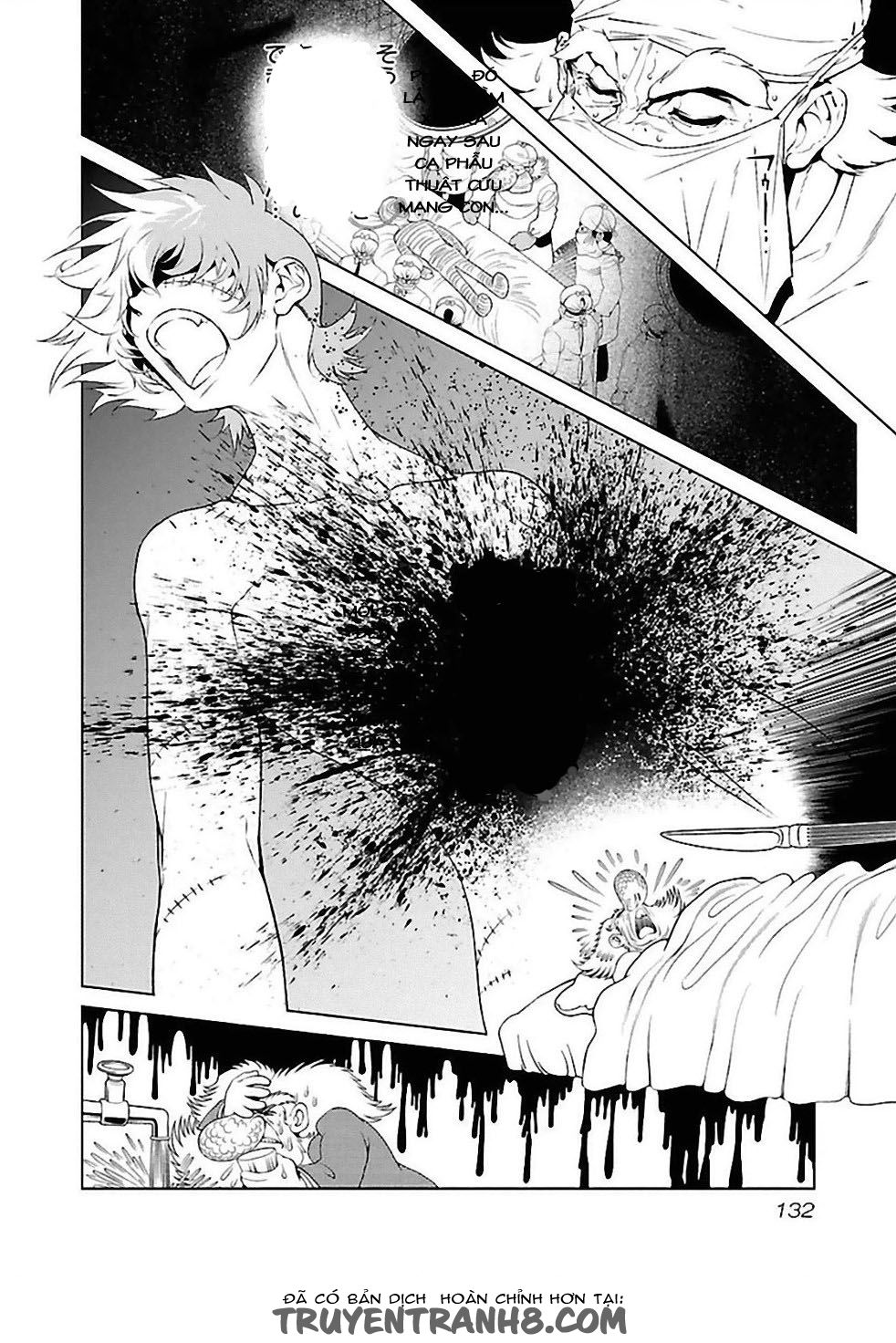 Thời Niên Thiếu Của Black Jack Chap 34 - Next Chap 35